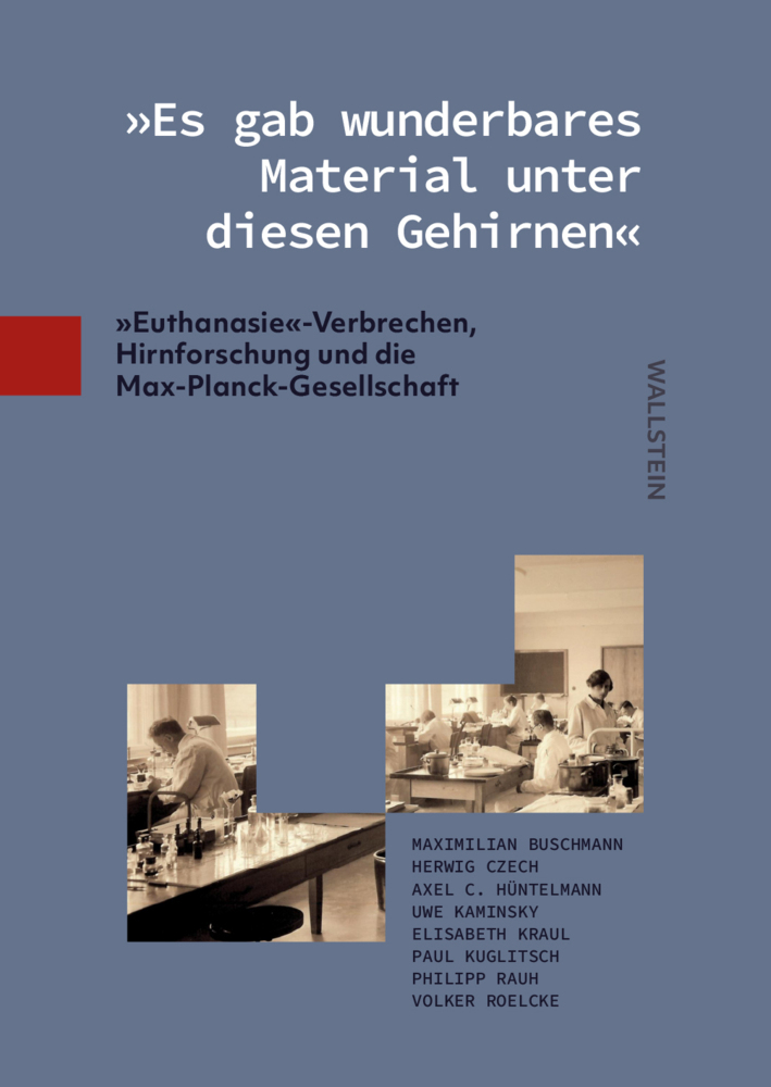 »Es gab wunderbares Material unter diesen Gehirnen«